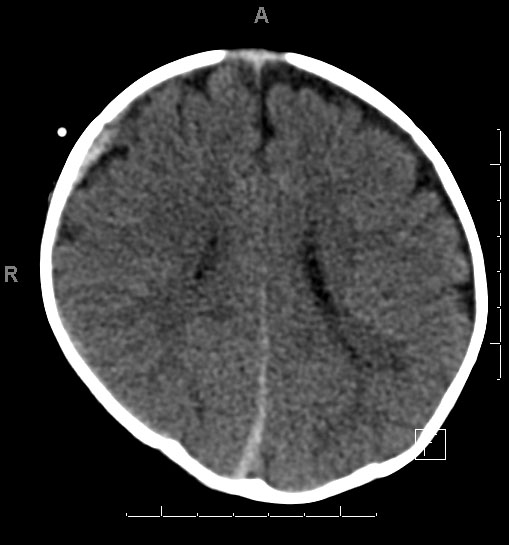 Case Image