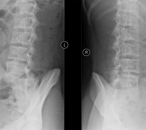 Case Image